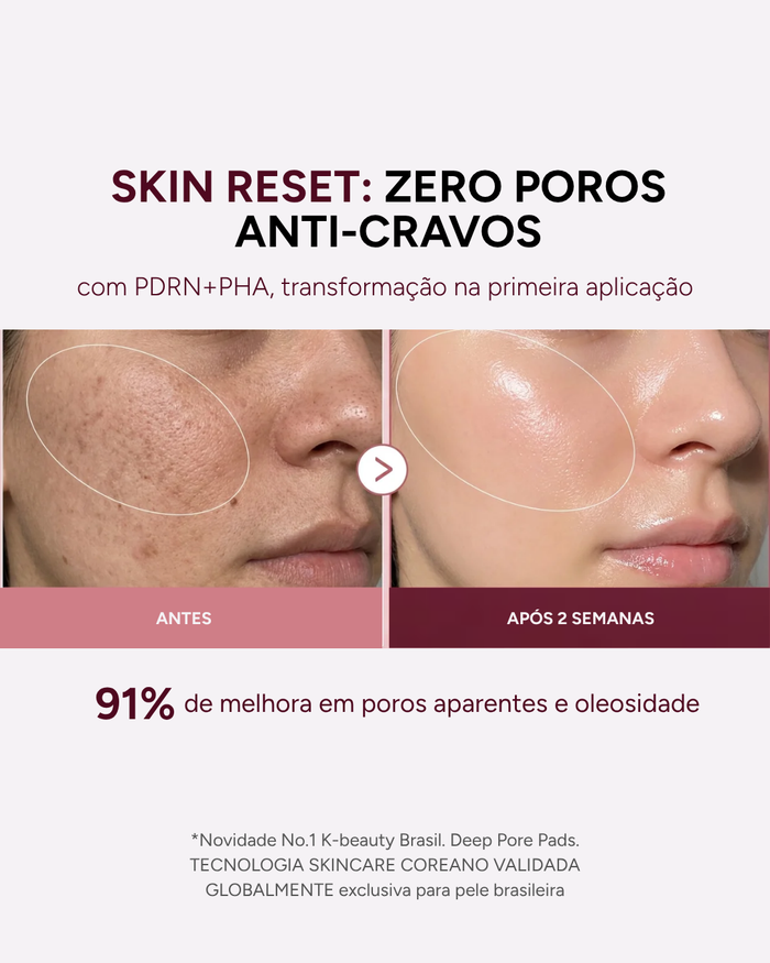 Adicione +1 Kit Deep Pore Pads
